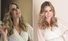 Cantora e apresentadora Luana Monalisa, mostra resultado de Rinoplastia