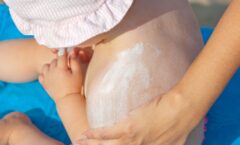 Verão e a pele dos bebês: entenda os cuidados necessários para deixá-los confortáveis nos dias mais quentes