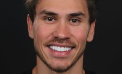 Referência em estética dental, Gustavo Nau vem ganhando o Brasil com as “Lentes com DNA de dente”